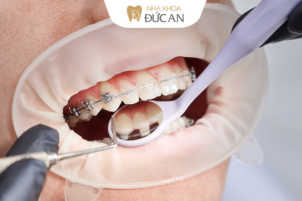 Nha khoa Đức An Nha Trang | Fnbmaps.com